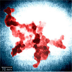 hyperpolymeres Hämoglobin
